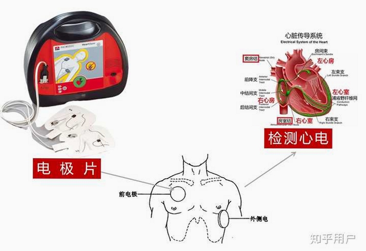 鱼跃心电使用教程