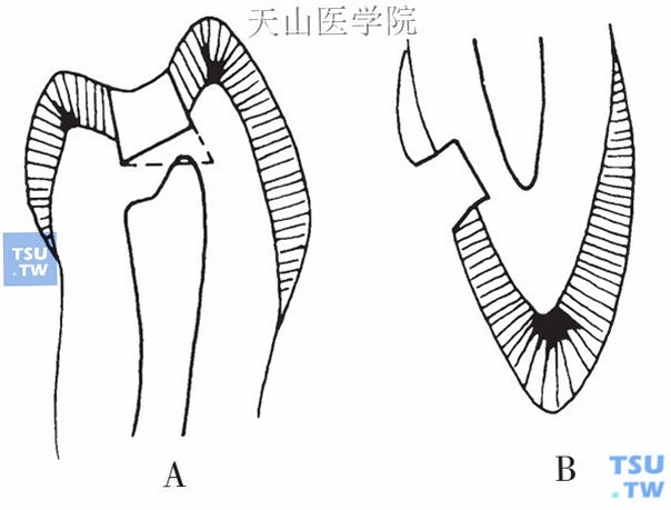 Wbit 功能对比