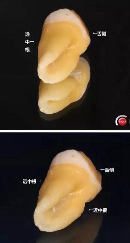 科掌门 卷帘门 匹配 教程