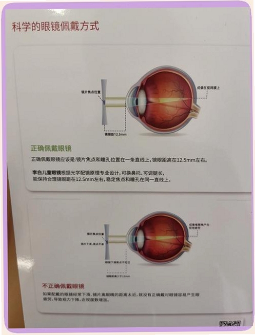 李白眼镜+操作步骤,文字可概括整篇文章全部内容,用于搜索配图