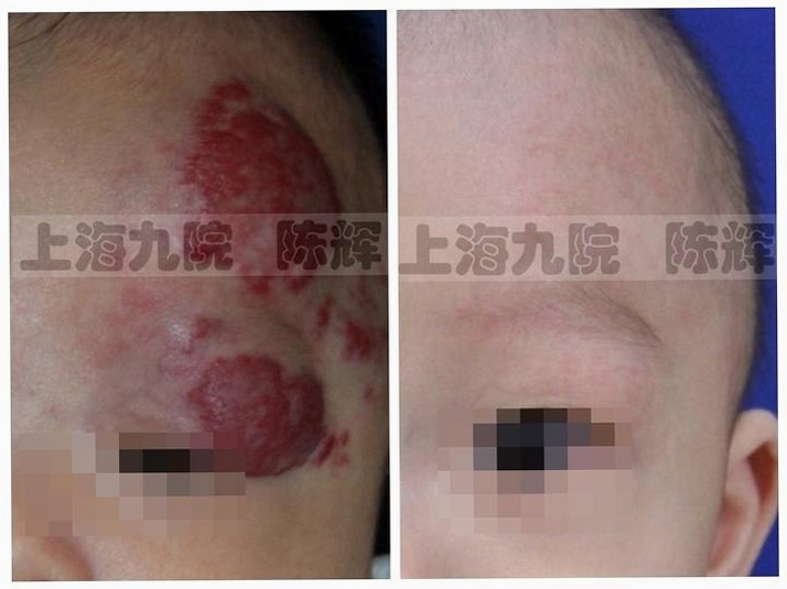 微步溯源x安装使用教程