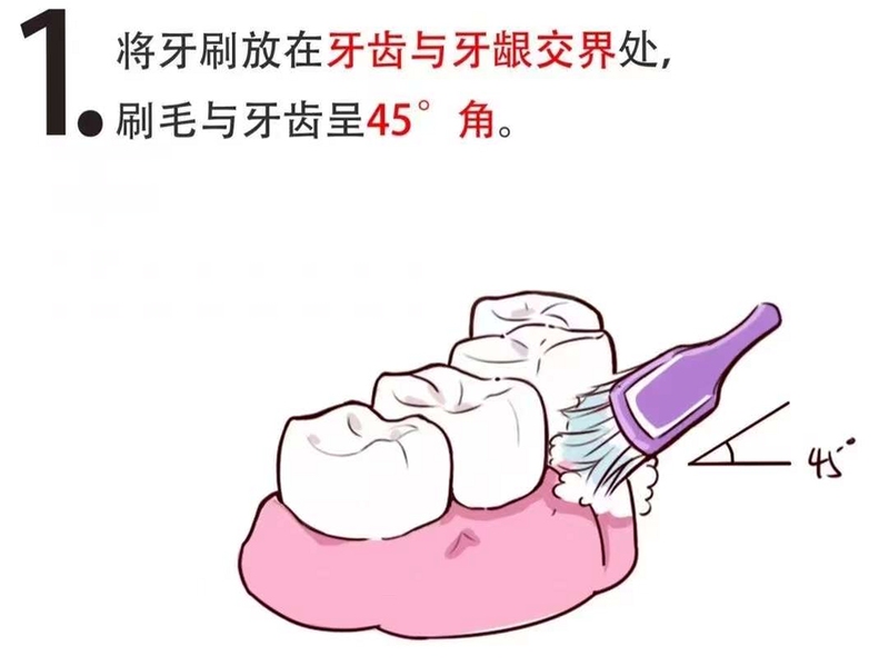 牙力给 使用方法 教程